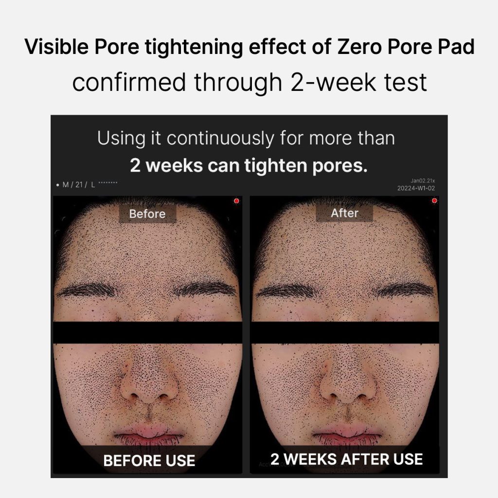 Medicube Zero Pore Pads 2.0 How to Use