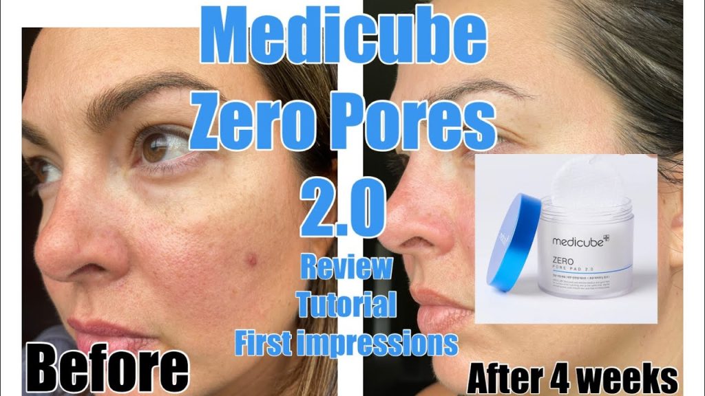 Medicube Zero Pore Pads 2.0 Review