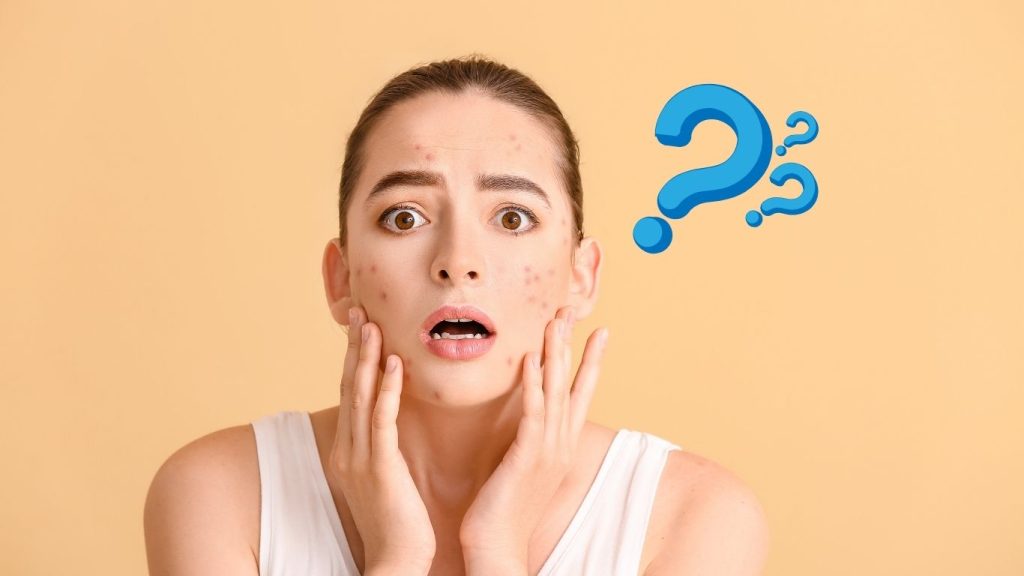 what is the best treatment for blemishes